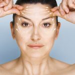 Things You Need To Know Before Considering Brow Lift Surgery