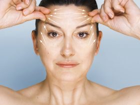 Things You Need To Know Before Considering Brow Lift Surgery